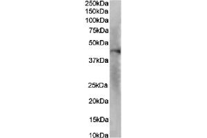 Western Blot using anti-IL-8RA antibody SE2. (Recombinant CXCR2 antibody  (N-Term))