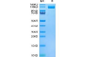 Biotinylated Human ENPP-3 on Tris-Bis PAGE under reduced condition. (ENPP3 Protein (AA 48-875) (His-Avi Tag,Biotin))