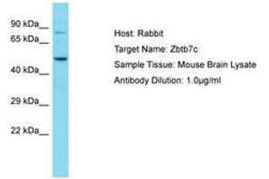 Image no. 1 for anti-Zinc Finger and BTB Domain Containing 7C (ZBTB7C) (AA 181-230) antibody (ABIN6750236) (ZBTB7C antibody  (AA 181-230))