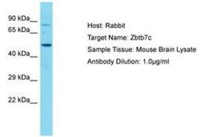 Image no. 1 for anti-Zinc Finger and BTB Domain Containing 7C (ZBTB7C) (AA 181-230) antibody (ABIN6750236)