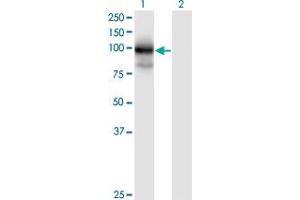 Western Blot analysis of MGC16169 expression in transfected 293T cell line by MGC16169 monoclonal antibody (M01), clone 7A7. (TBCK antibody  (AA 601-700))