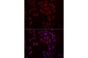Immunofluorescence analysis of A549 cell using FRZB antibody. (FRZB antibody)