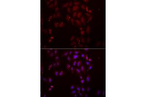 Immunofluorescence analysis of A549 cell using FRZB antibody. (FRZB antibody)