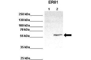 WB Suggested Anti-ETV1 Antibody    Positive Control:  Lane 1: 100ug untransfected HEK293 lysate Lane 2: 33ug ER81 transfected HEK293 lysate   Primary Antibody Dilution :   1:1000  Secondary Antibody :  Anti-rabbit-HRP   Secondry Antibody Dilution :   1:2000  Submitted by:  Anonymous (ETV1 antibody  (Middle Region))