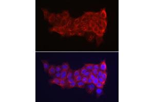 Immunofluorescence analysis of A-431 cells using Cytokeratin 14 (KRT14) Rabbit pAb (ABIN7268092) at dilution of 1:150 (40x lens). (KRT14 antibody  (C-Term))