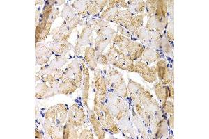 Immunohistochemistry of paraffin-embedded rat heart using MBNL1 antibody. (MBNL1 antibody  (AA 1-382))