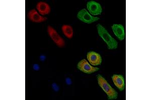 ABIN6263623 and ABIN6269340 staining Hela cells by IF/ICC.