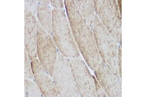 Immunohistochemistry of paraffin-embedded mouse skeletal muscle using  Rabbit pAb (ABIN6127422, ABIN6136487, ABIN6136489 and ABIN6216551) at dilution of 1:500 (40x lens). (ACTN3 antibody  (AA 580-630))