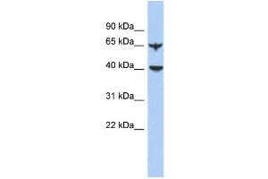 WB Suggested Anti-APOBEC4 Antibody Titration: 0. (APOBEC4 antibody  (N-Term))