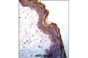 Kallikrein 7(KLK7) Antibody immunohistochemistry analysis in formalin fixed and paraffin embedded human skin tissue followed by peroxidase conjugation of the secondary antibody and DAB staining. (Kallikrein 7 antibody  (C-Term))