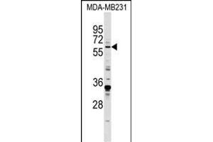 EGR1 Antibody (N-term) (ABIN389442 and ABIN2839514) western blot analysis in MDA-M cell line lysates (35 μg/lane). (EGR1 antibody  (N-Term))