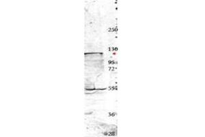 Image no. 1 for anti-Neural Precursor Cell Expressed, Developmentally Down-Regulated 4, E3 Ubiquitin Protein Ligase (NEDD4) (Internal Region) antibody (ABIN293884) (NEDD4 antibody  (Internal Region))