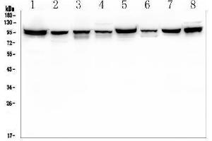 Western blot analysis of PDCD6IP using anti-PDCD6IP antibody (ABIN7600490).