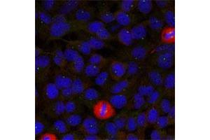 Immunofluorescence staining of methanol-fixed HeLa cells using EIF4G1 polyclonal antibody . (EIF4G1 antibody  (Ser1232))