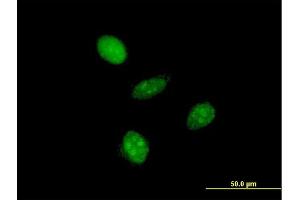 Immunofluorescence of monoclonal antibody to GTF2A1L on HeLa cell. (GTF2A1L antibody  (AA 251-348))