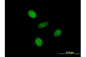 Immunofluorescence of monoclonal antibody to GTF2A1L on HeLa cell. (GTF2A1L antibody  (AA 251-348))