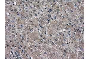 Immunohistochemical staining of paraffin-embedded liver tissue using anti-DPP4mouse monoclonal antibody.