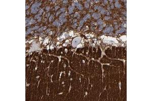 Immunohistochemical staining of human cerebellum with CADM3 polyclonal antibody  shows strong positivity in neuropil.