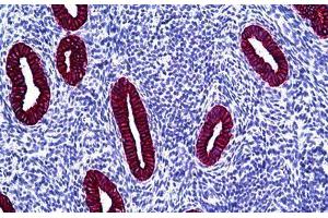Human Uterus: Formalin-Fixed, Paraffin-Embedded (FFPE) (Keratin Basic antibody)