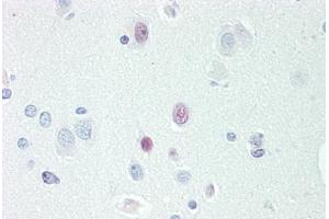 Human Brain, Cortex: Formalin-Fixed, Paraffin-Embedded (FFPE) (TCEAL3 antibody  (AA 15-43))