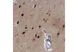 Immunohistochemical staining of human cerebral cortex with SOX7 polyclonal antibody  shows strong nuclear positivity in neuronal cells at 1:50-1:200 dilution.