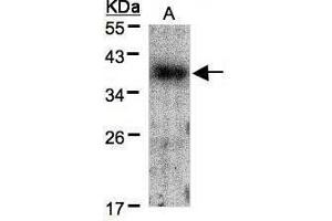 WB Image Sample(30 μg of whole cell lysate) A:A431, 12% SDS PAGE antibody diluted at 1:1500 (Crk antibody  (Center))