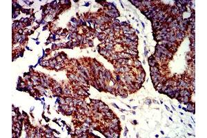 Immunohistochemistry (IHC) image for anti-Purinergic Receptor P2Y, G-Protein Coupled, 1 (P2RY1) antibody (ABIN5611276)