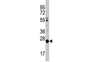 Western blot analysis of LIN28B antibody and HL-60 lysate (LIN28B antibody  (AA 218-250))