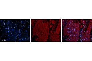Rabbit Anti-ZFP36L1 Antibody  Catalog Number: ARP33382_P050 Formalin Fixed Paraffin Embedded Tissue: Human Adult heart  Observed Staining: Cytoplasmic Primary Antibody Concentration: 1:600 Secondary Antibody: Donkey anti-Rabbit-Cy2/3 Secondary Antibody Concentration: 1:200 Magnification: 20X Exposure Time: 0.