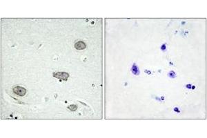 Immunohistochemistry analysis of paraffin-embedded human brain, using CSFR (Phospho-Tyr809) Antibody. (CSF1R antibody  (pTyr809))
