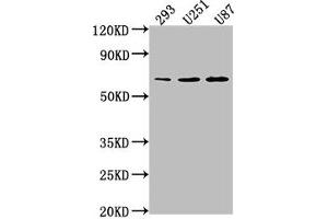 Western Blot Positive WB detected in: 293 whole cell lysate, U251 whole cell lysate, U87 whole cell lysate All lanes: TCF7L1 antibody at 1:1000 Secondary Goat polyclonal to rabbit IgG at 1/50000 dilution Predicted band size: 63 kDa Observed band size: 63 kDa (TCF7L1 antibody  (AA 80-99))
