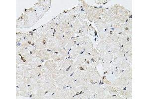Immunohistochemistry of paraffin-embedded Mouse heart using GTF2H2 Polyclonal Antibody at dilution of 1:100 (40x lens). (GTF2H2 antibody)