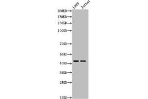 Western Blot analysis of L929Jurkat cells using Acetyl-E2F-4 (K96) Polyclonal Antibody (E2F4 antibody  (acLys96))