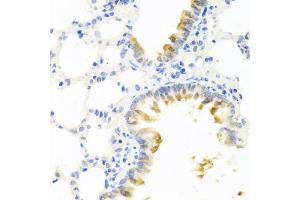 Immunohistochemistry of paraffin-embedded mouse lung using KLK11 antibody (ABIN6291422) at dilution of 1:100 (40x lens).