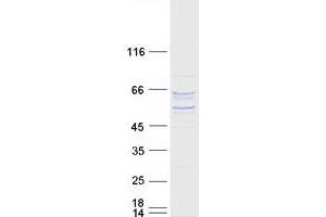 Western Blotting (WB) image for Prolyl 4-Hydroxylase, alpha Polypeptide II (P4HA2) (Transcript Variant 2) protein (Myc-DYKDDDDK Tag) (ABIN2728092)