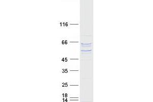 Validation with Western Blot (P4HA2 Protein (Transcript Variant 2) (Myc-DYKDDDDK Tag))