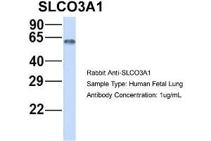 Host:  Rabbit  Target Name:  SLCO3A1  Sample Type:  Human Fetal Lung  Antibody Dilution:  1. (Solute Carrier Organic Anion Transporter Family, Member 3A1 (SLCO3A1) (Middle Region) antibody)