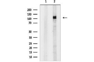 anti-tyrosine Kinase, Non-Receptor, 2 (TNK2) (C-Term) antibody