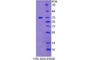 Image no. 1 for PTK6 Protein tyrosine Kinase 6 (PTK6) (AA 191-445) protein (His tag) (ABIN4990208) (PTK6 Protein (AA 191-445) (His tag))