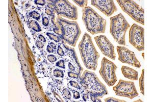 Immunohistochemistry (IHC) image for anti-Tumor Necrosis Factor Receptor Superfamily, Member 10b (TNFRSF10B) (AA 233-440) antibody (ABIN5518794)