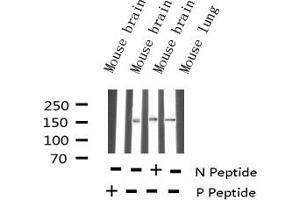 Western blot analysis of Phospho-Bcr (Tyr177) expression in various lysates (BCR antibody  (pTyr177))
