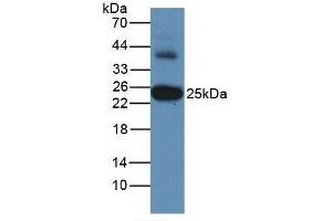 Figure. (GSTA3 antibody  (AA 1-222))