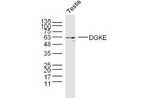 Mouse testis lysates probed with DGKE Polyclonal Antibody, unconjugated  at 1:300 overnight at 4°C followed by a conjugated secondary antibody at 1:10000 for 90 minutes at 37°C. (DGKE antibody  (AA 1-100))