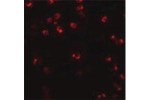 Immunofluorescence staining of human spleen tissue with 20 ug/mL NLRP3 polyclonal antibody . (NLRP3 antibody  (AA 120-170))