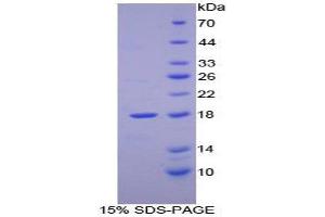SDS-PAGE (SDS) image for Retinol Binding Protein 2, Cellular (RBP2) (AA 1-134) protein (His tag) (ABIN1080637) (RBP2 Protein (AA 1-134) (His tag))