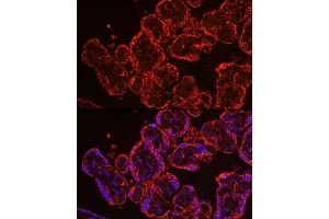Immunofluorescence analysis of human placenta using CYP11 Rabbit pAb (6363) at dilution of 1:100 (40x lens).