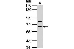 WB Image Sample (30 ug of whole cell lysate) A: Molt-4 , 7. (SHC4 antibody  (Center))