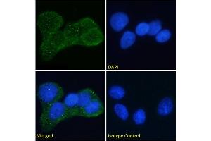 Immunofluorescence staining of fixed MCF7 cells with anti-Insulin receptor alpha antibody Fab 83-7. (Recombinant ISR-alpha antibody)