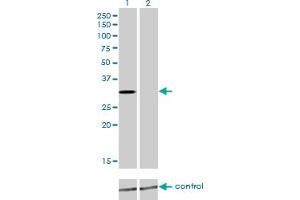 Western blot analysis of KCNIP2 over-expressed 293 cell line, cotransfected with KCNIP2 Validated Chimera RNAi (Lane 2) or non-transfected control (Lane 1). (KCNIP2 antibody  (AA 1-100))