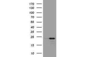 Image no. 1 for anti-Visinin-Like 1 (VSNL1) (AA 2-191) antibody (ABIN1491148) (VSNL1 antibody  (AA 2-191))